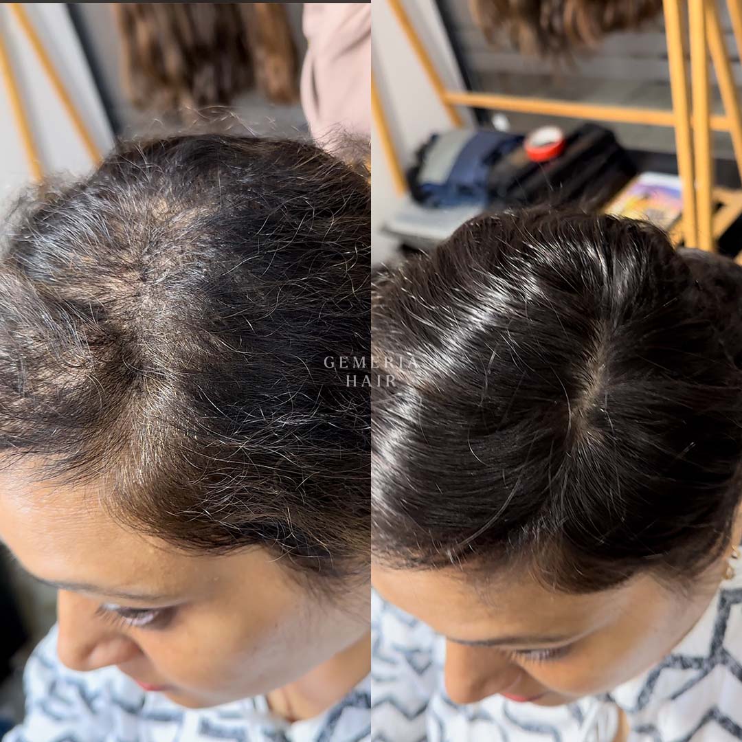 client overview with silk hair topper 