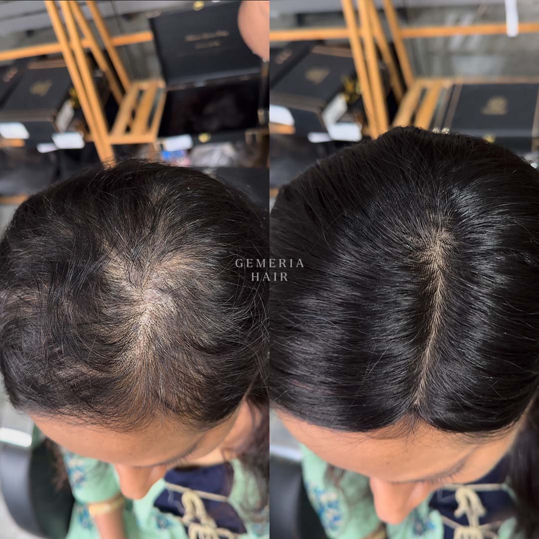3"x5" silk hair topper before after