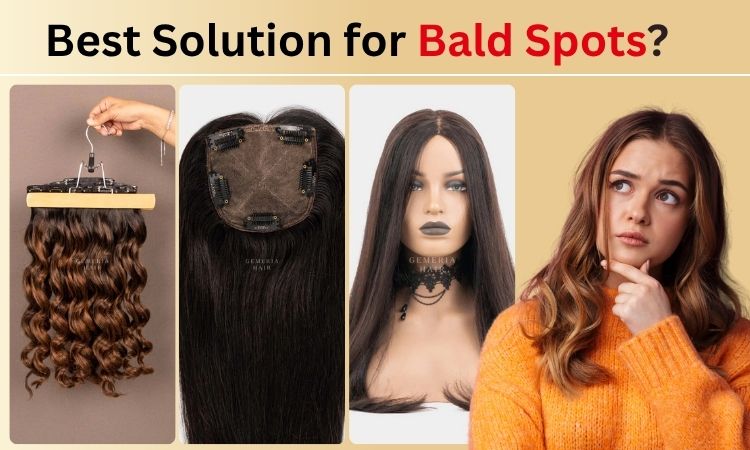 best solution for bald spots