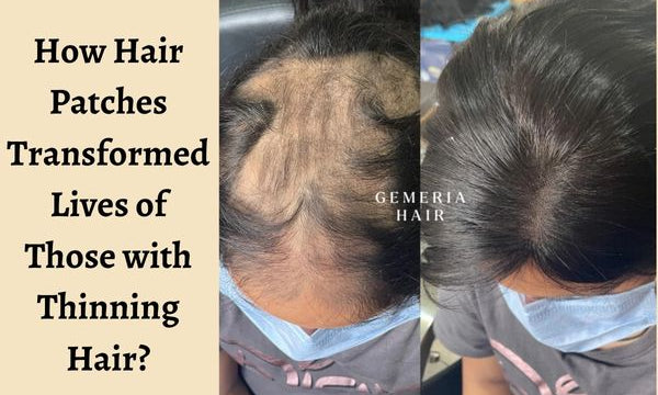 hair patch benefits