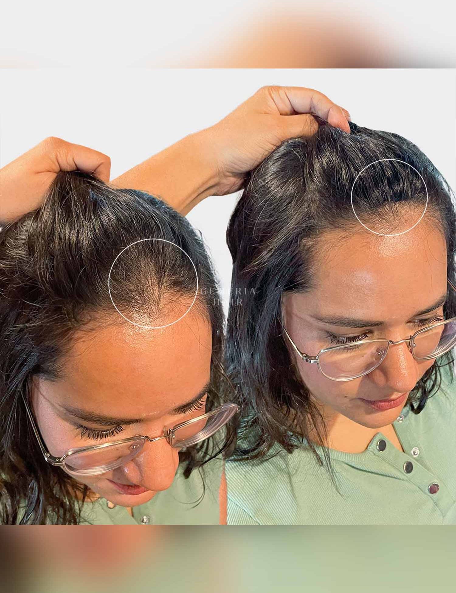 Cover-up hair patch