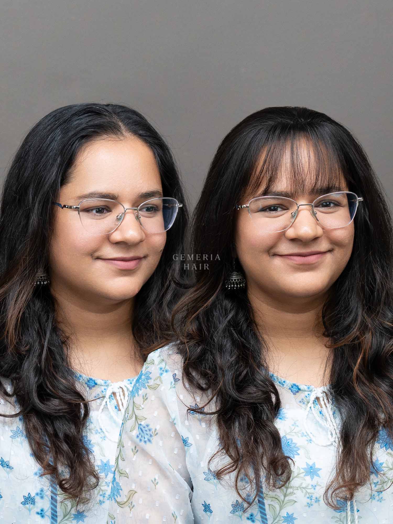 Frontline Hair Patch With Bangs