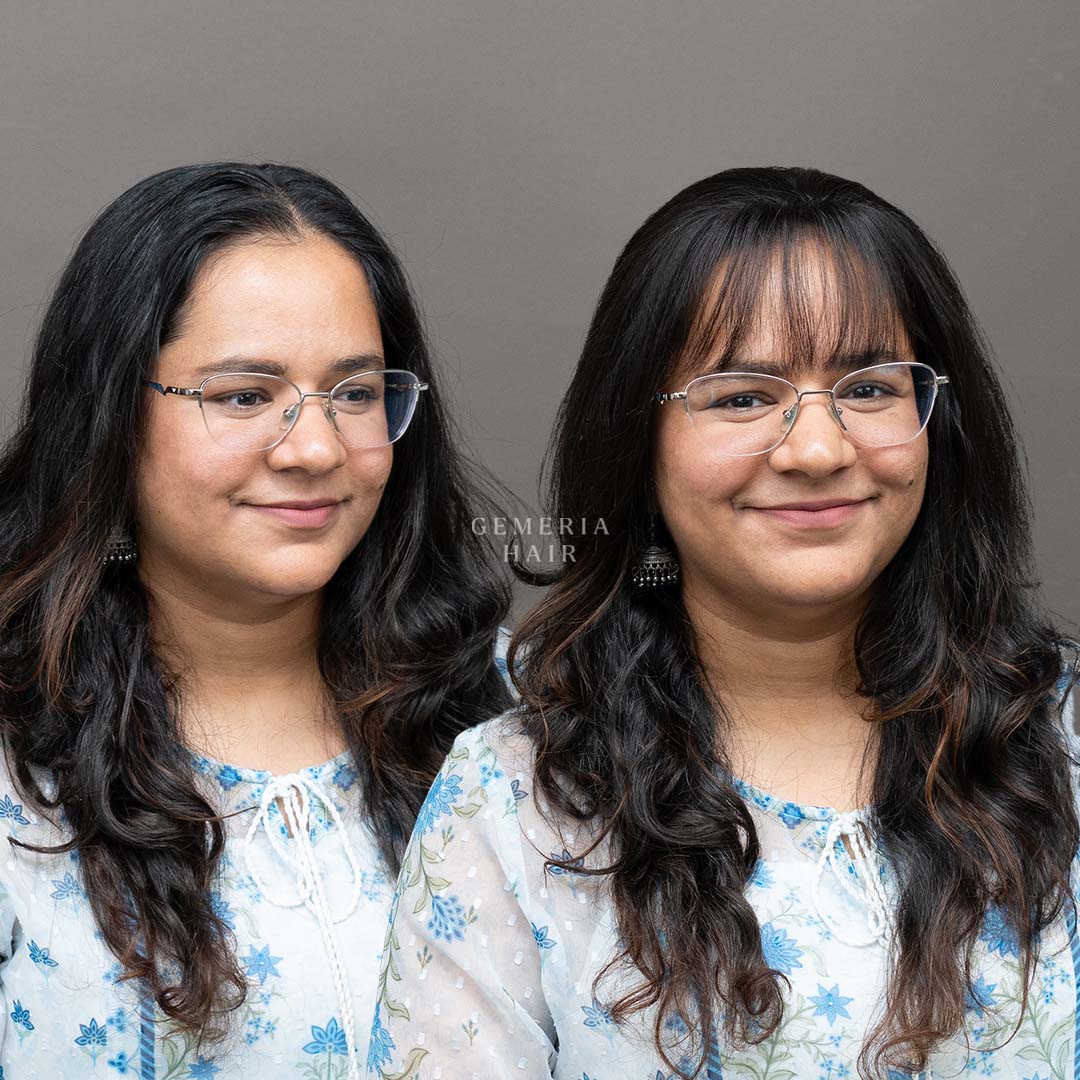 before and after wearing frontline hair patch with bangs