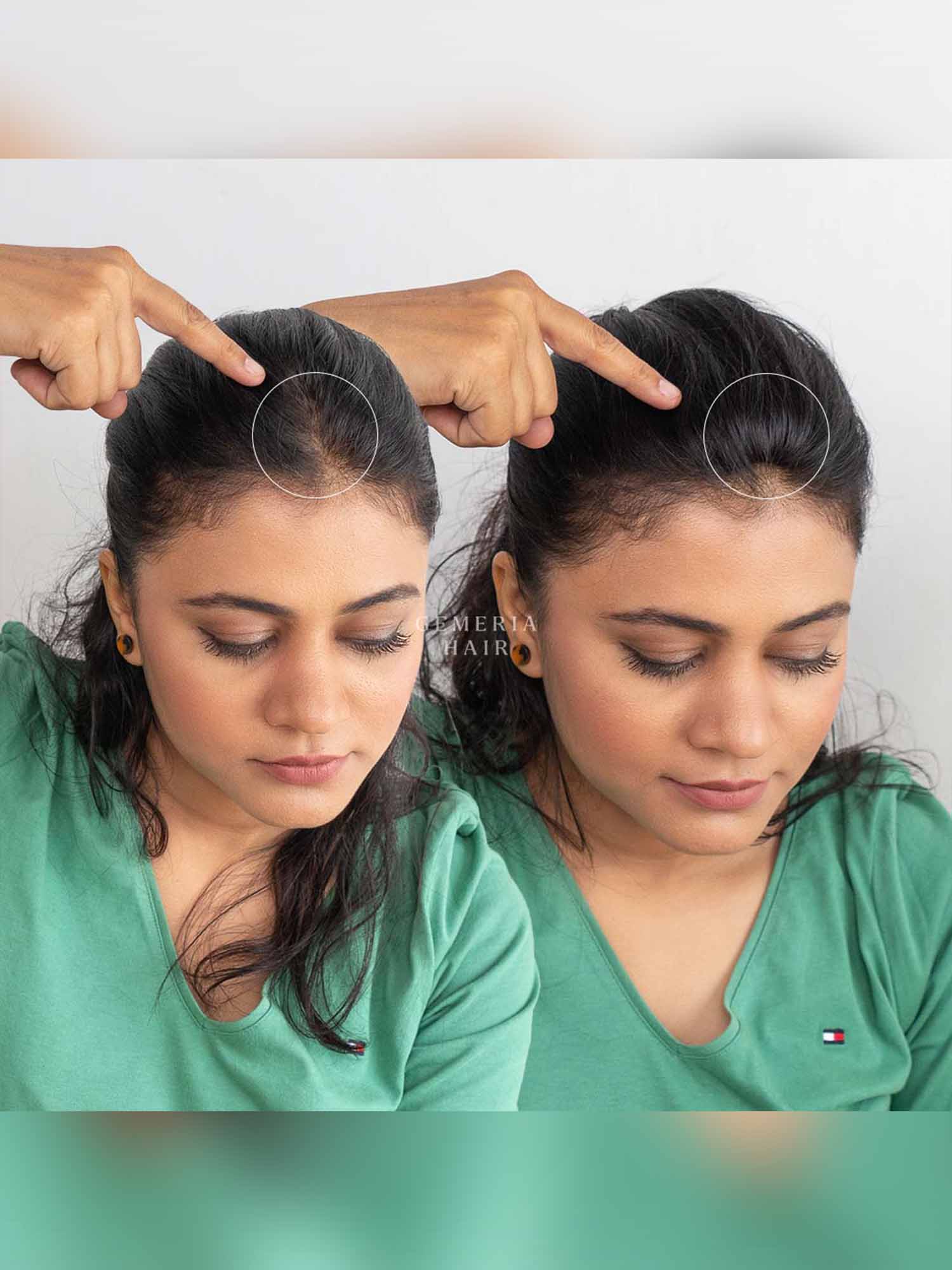 Invisible Spot Cover-Up Hair Patch