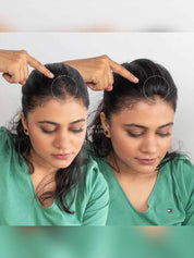Invisible Spot Cover-Up Hair Patch