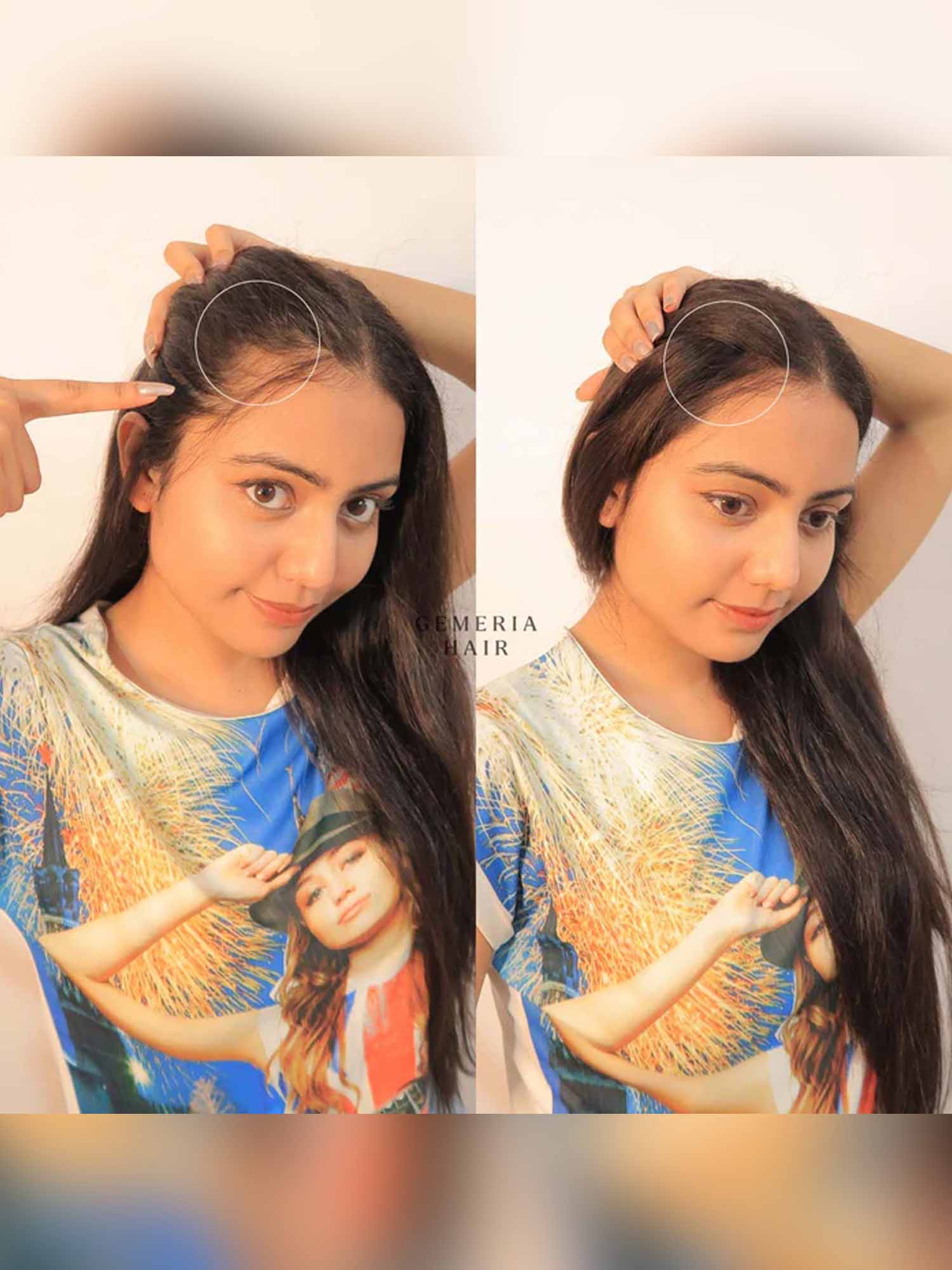 Invisible Spot Cover-Up Hair Patch