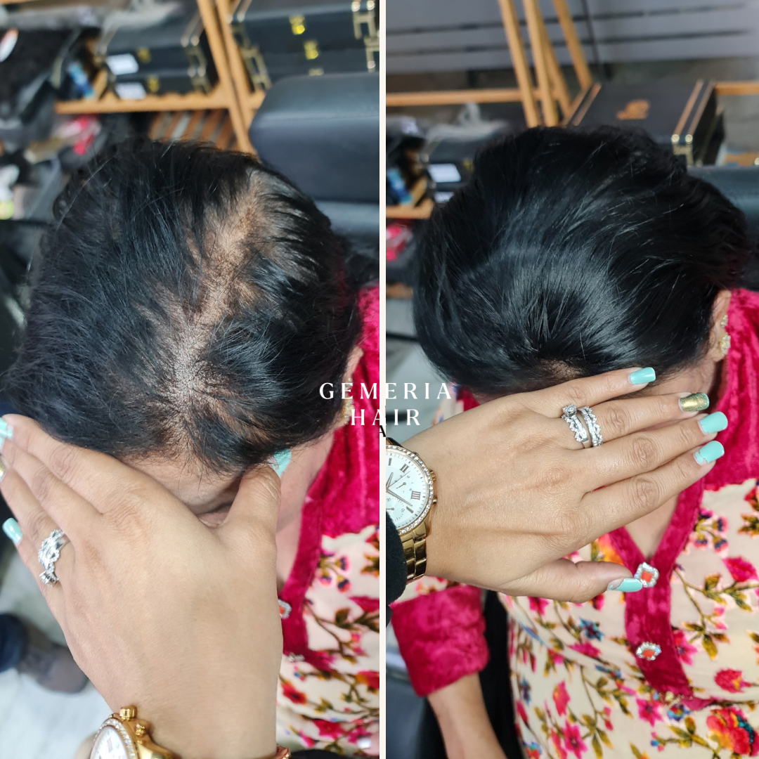 Invisible Wide Cover-Up | 3" Hair Patch