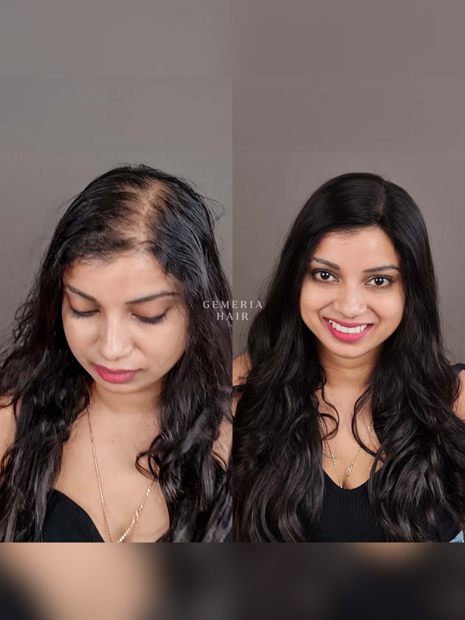 5"x5" | Essential Hair Topper