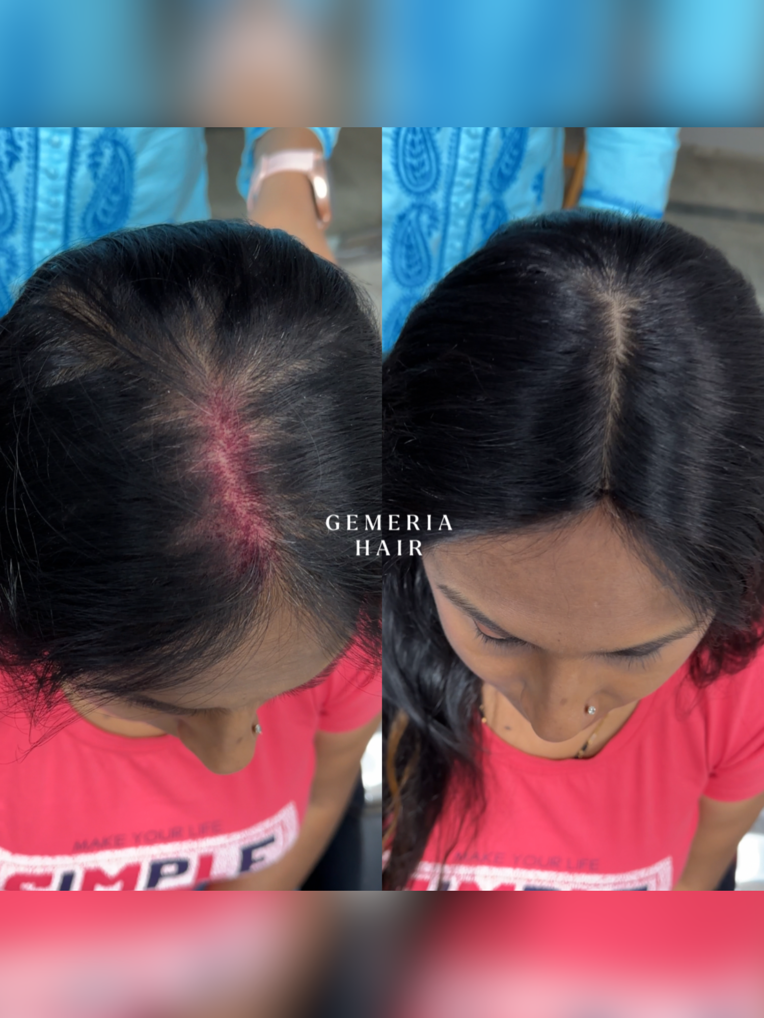 2"x4" | Silk Hair Topper