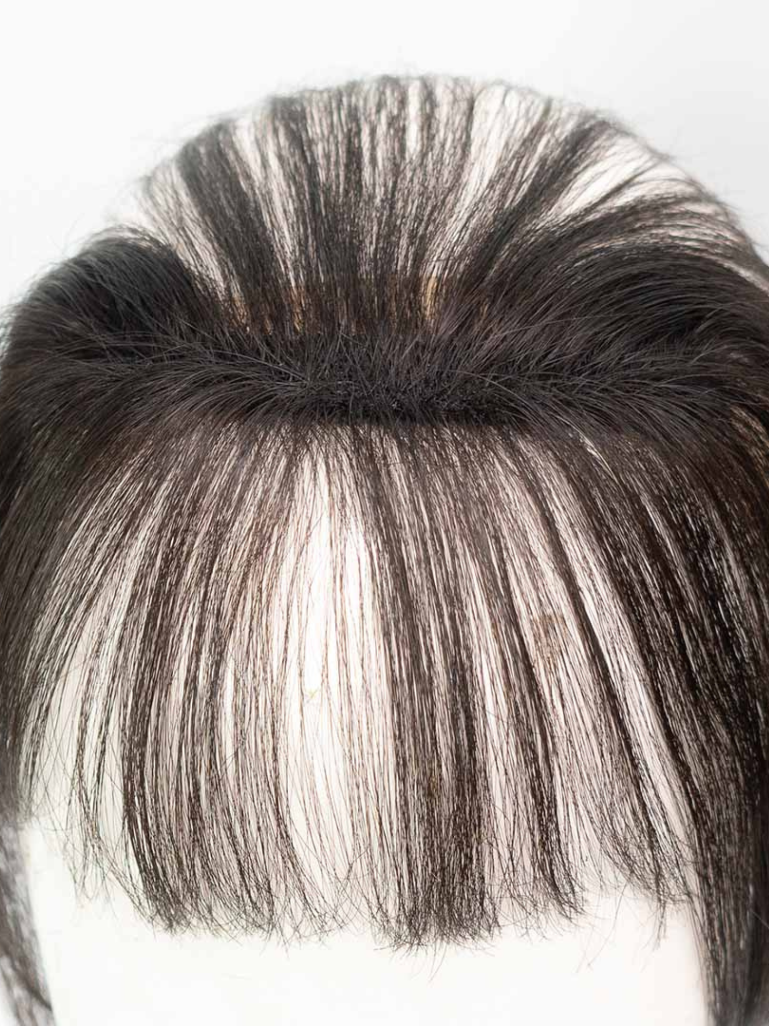 Frontline Hair Patch With Bangs