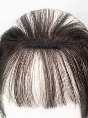 Frontline Hair Patch With Bangs