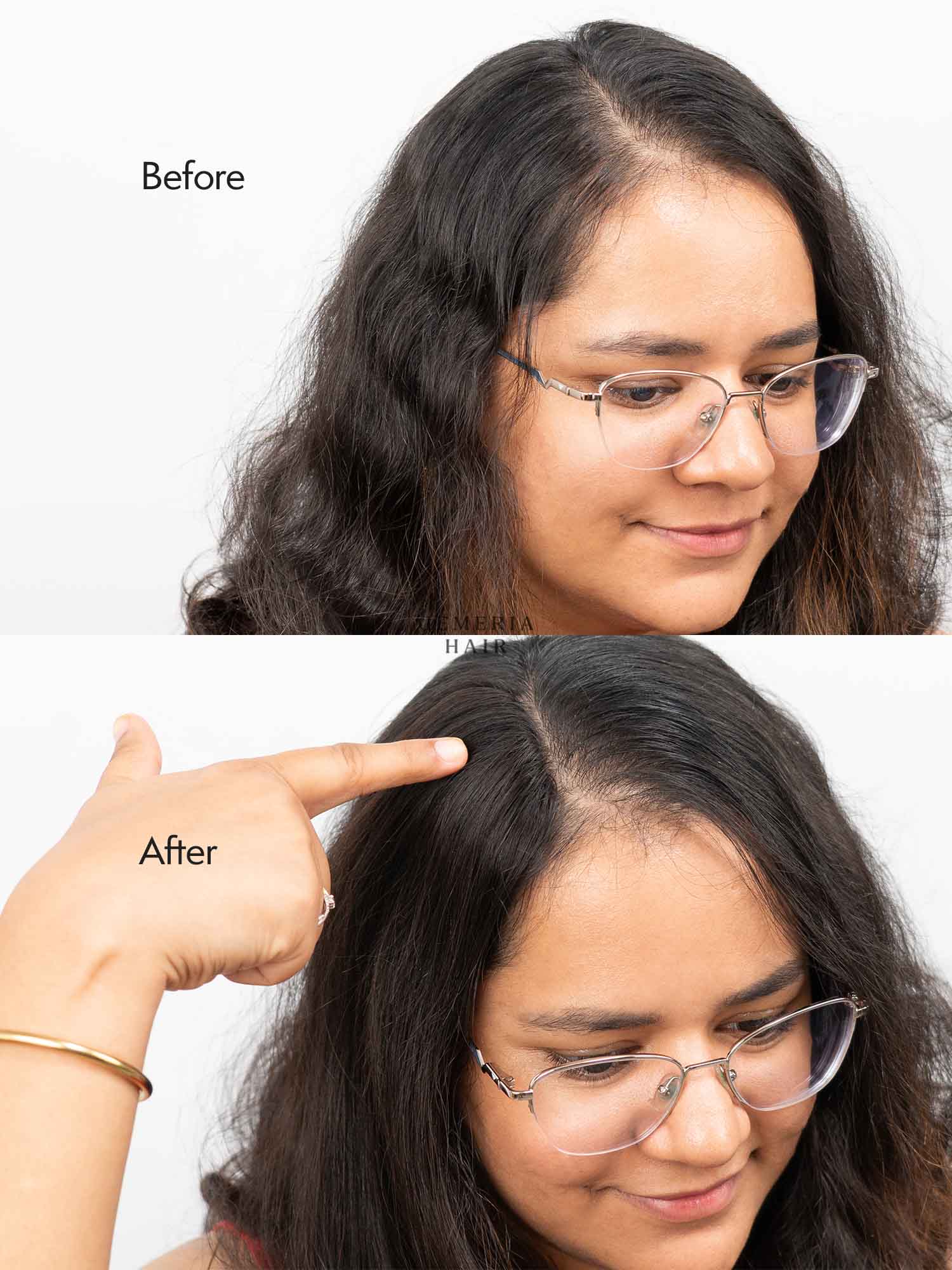 Invisible Slim Cover Up Hair Patch