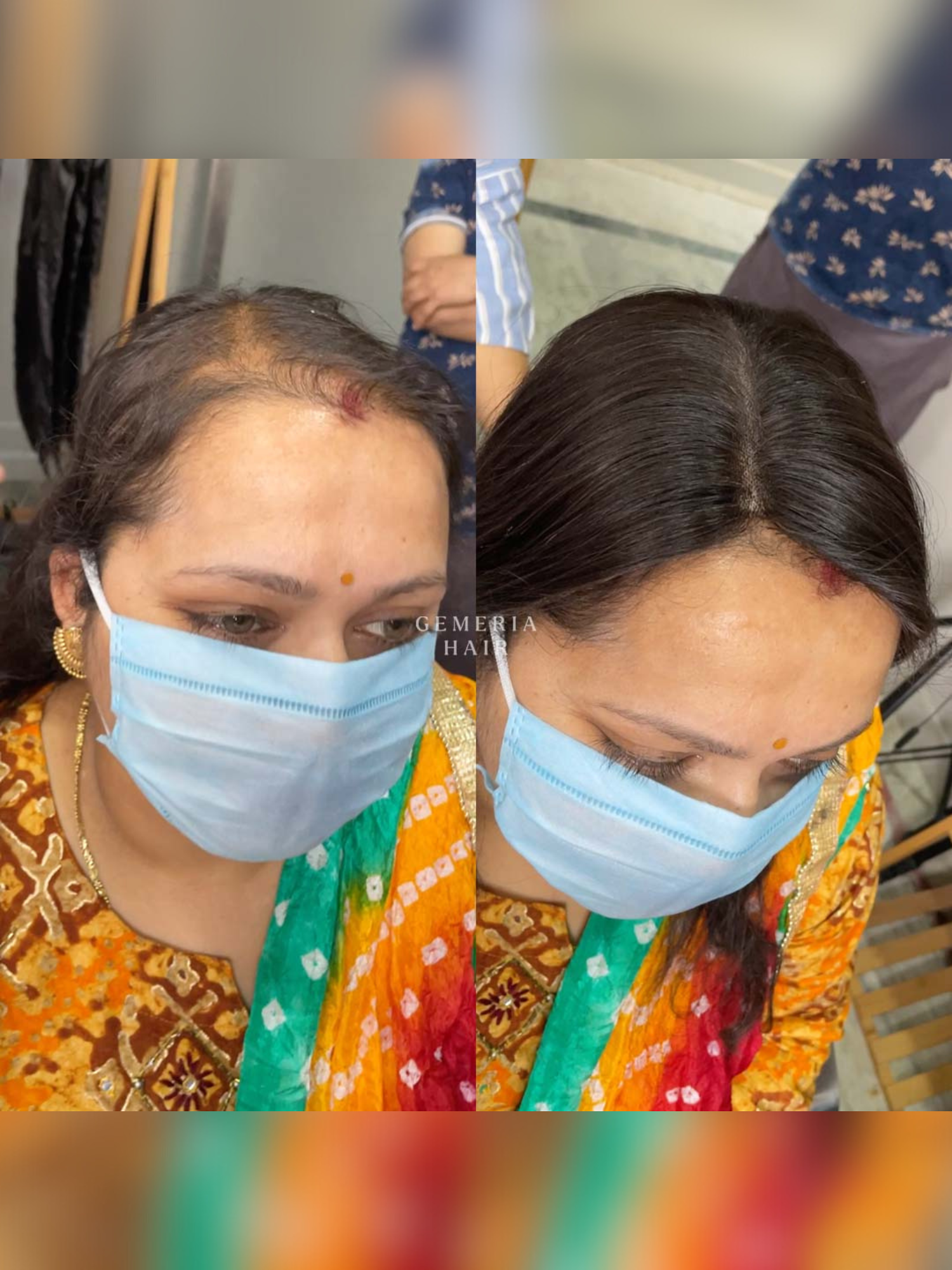 3"x5" | Essential Hair Topper