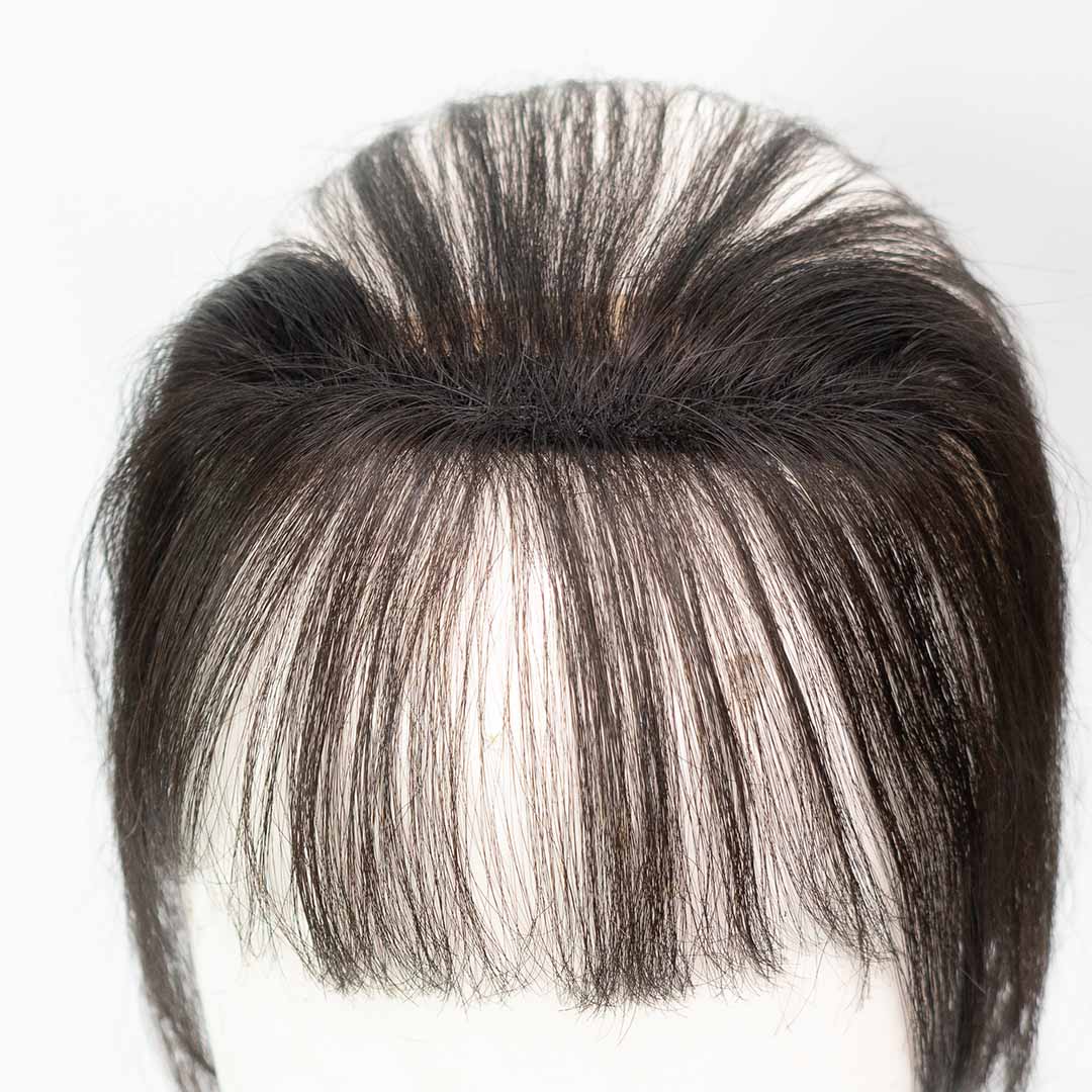 frontline hair patch with bangs closeup