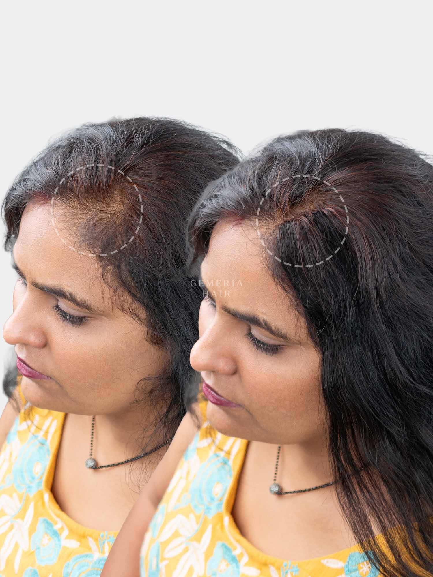 Invisible Spot Cover-Up Hair Patch