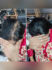 Invisible Wide Cover-Up Hair Patch