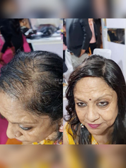 5"x5" | Essential Hair Topper