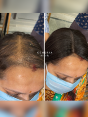 5"x5" | Essential Hair Topper