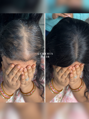 5"x5" | Essential Hair Topper