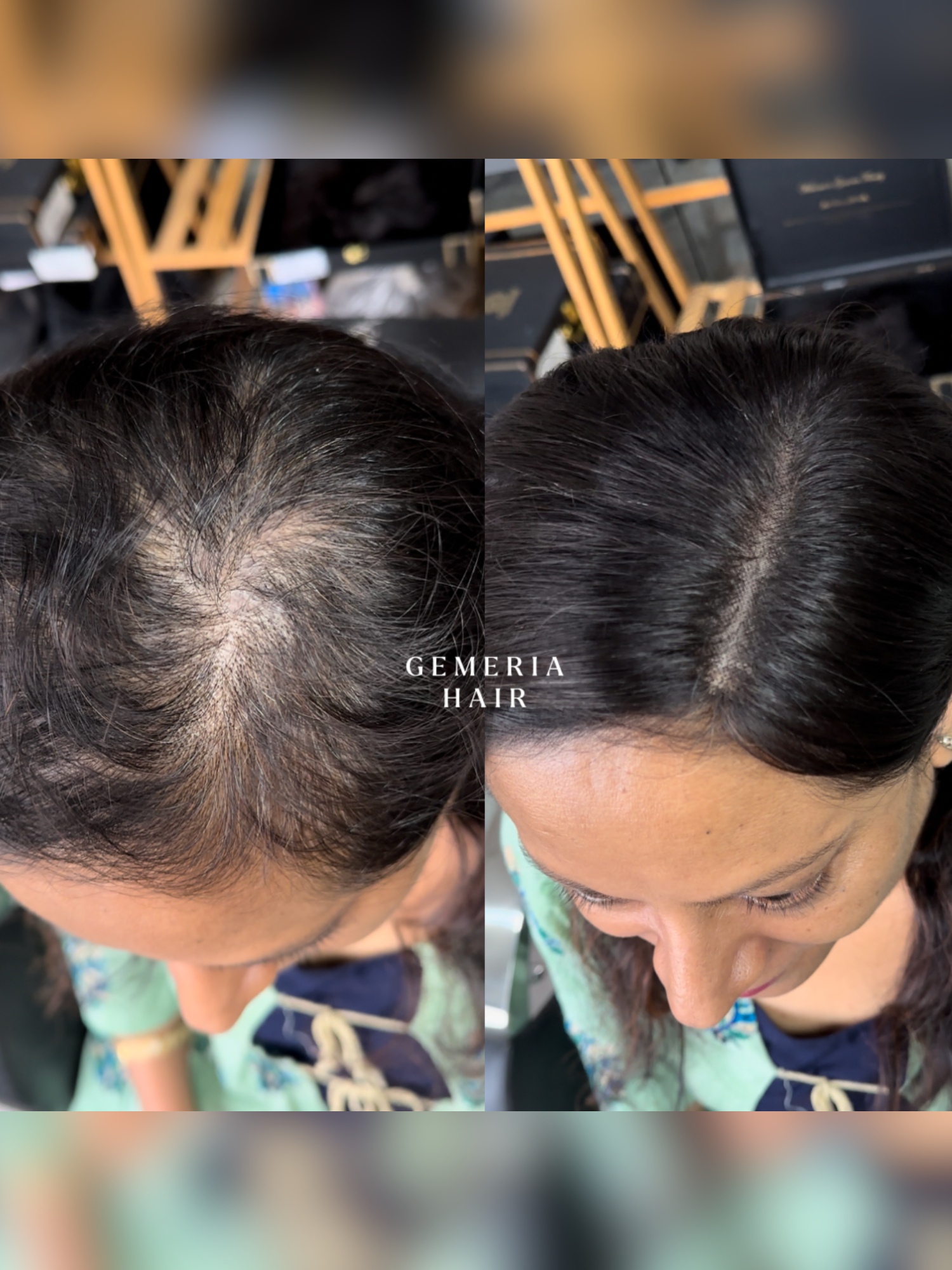5"x5" | Essential Hair Topper