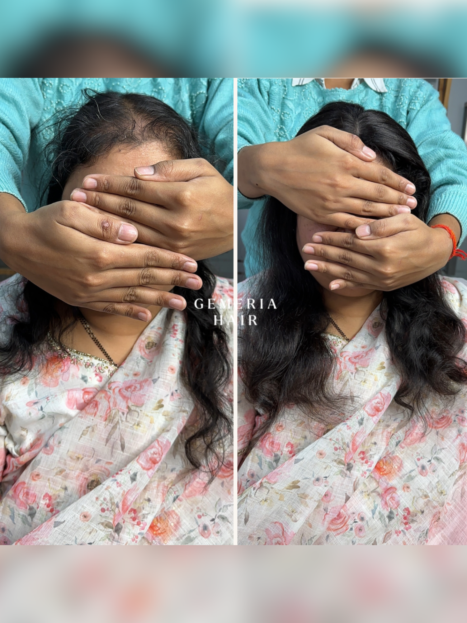 5"x5" | Essential Hair Topper