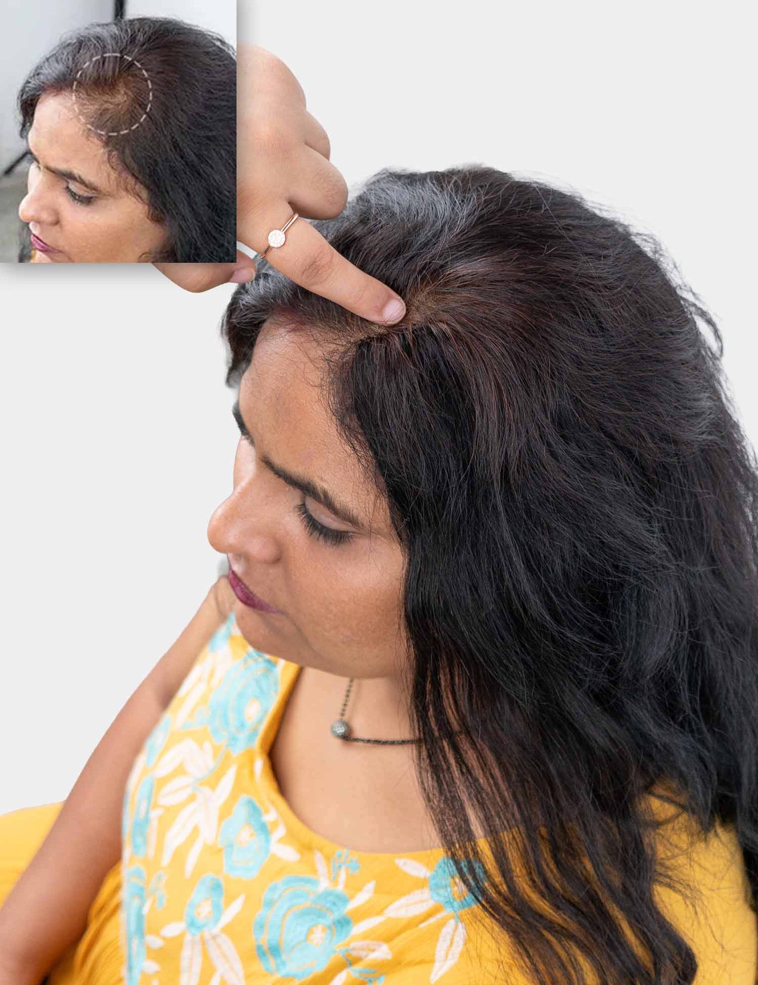 Cover-up hair patch