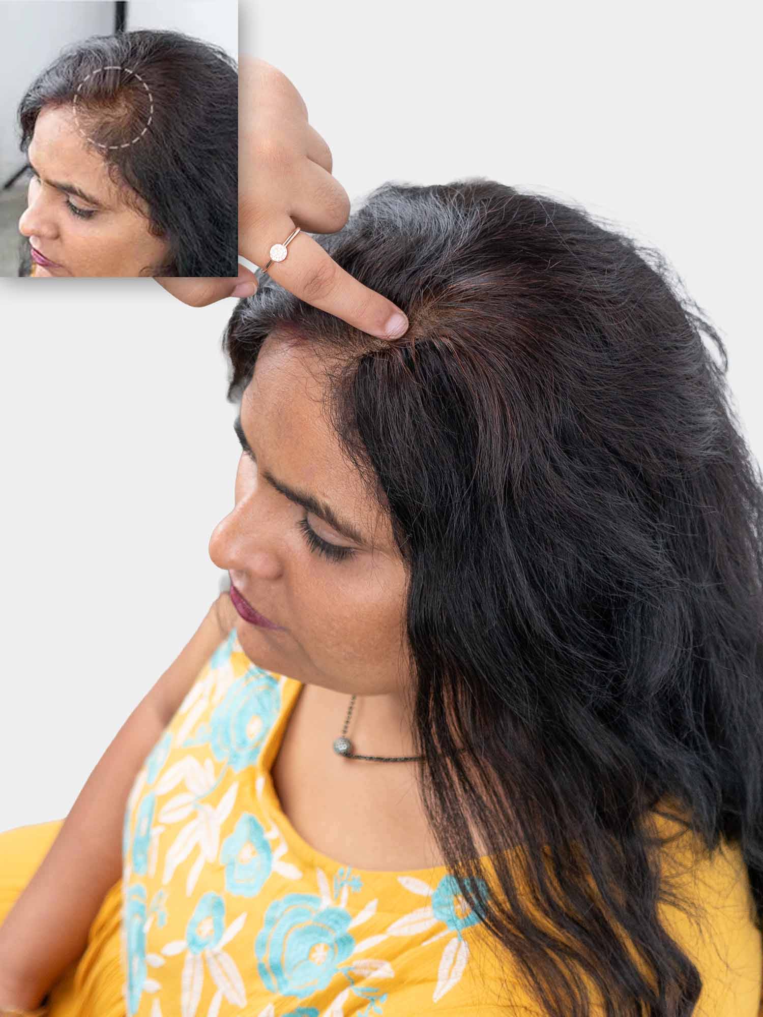 Cover-up hair patch