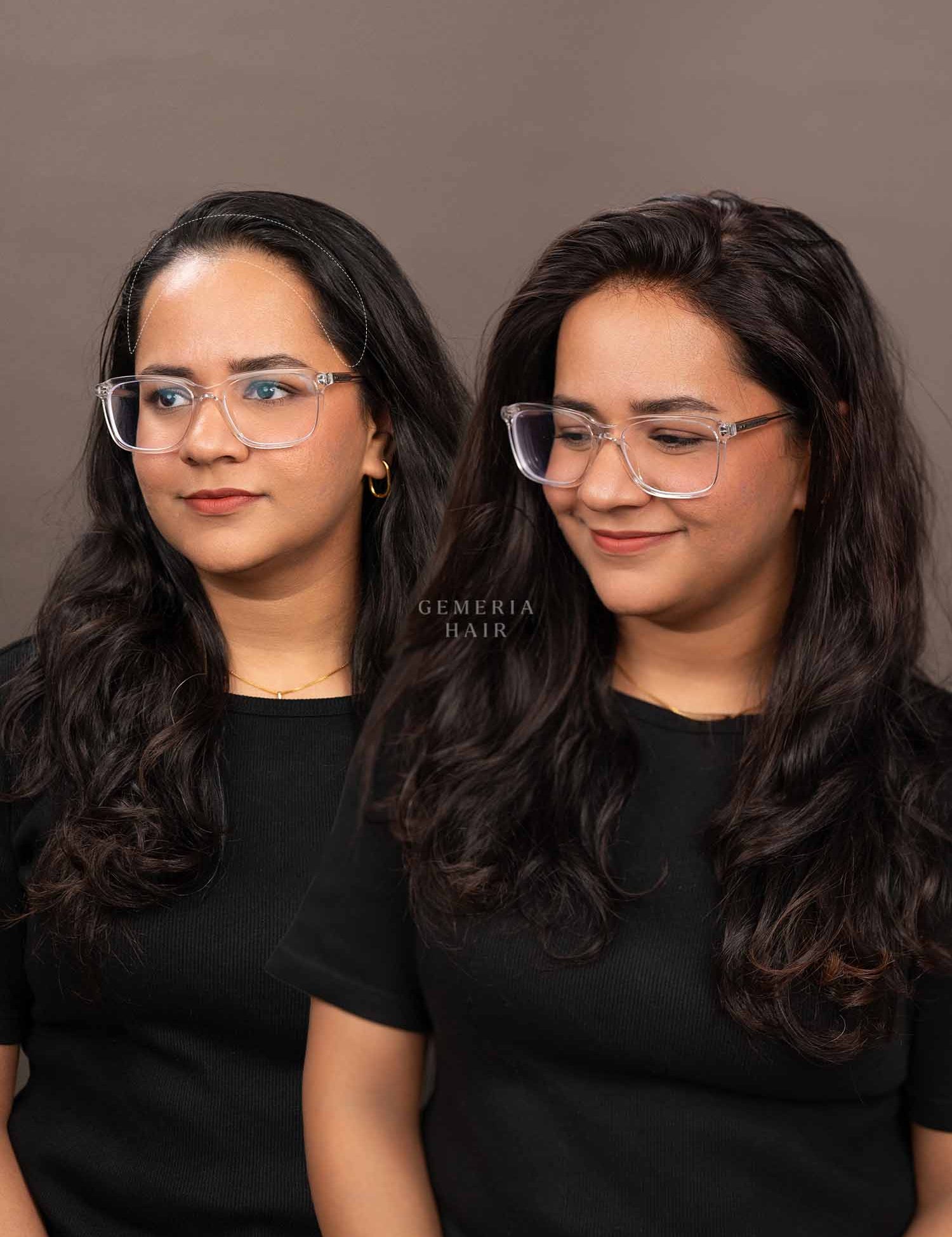 Women wearing human hair front hairline topper from front angle