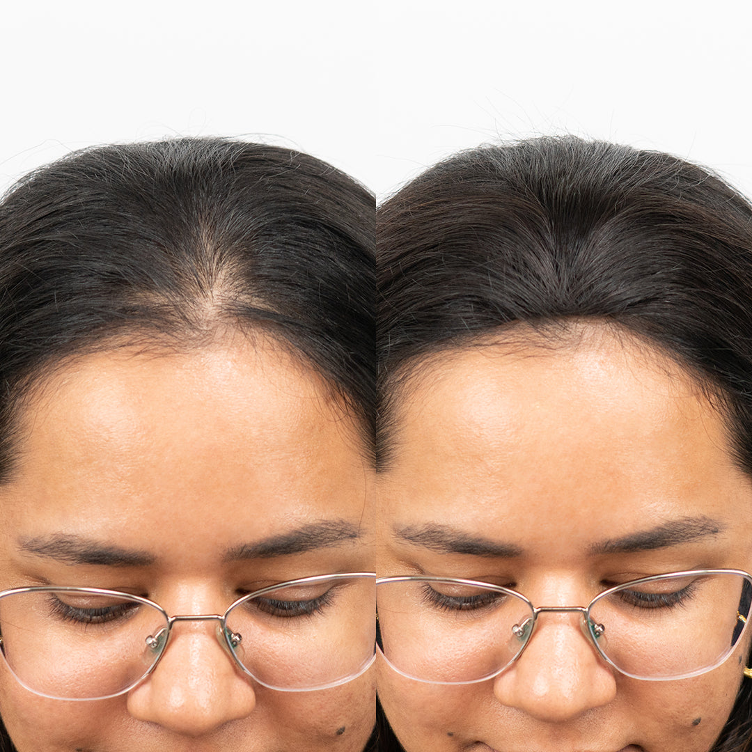 before and after wearing invisible slim cover up hair patch closeup 